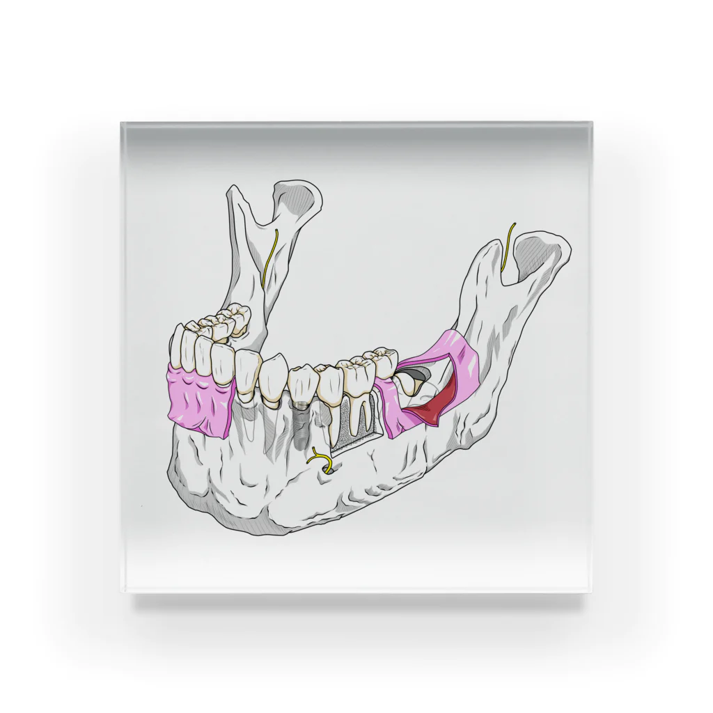 KAAK studioの下顎骨解剖カラー アクリルブロック