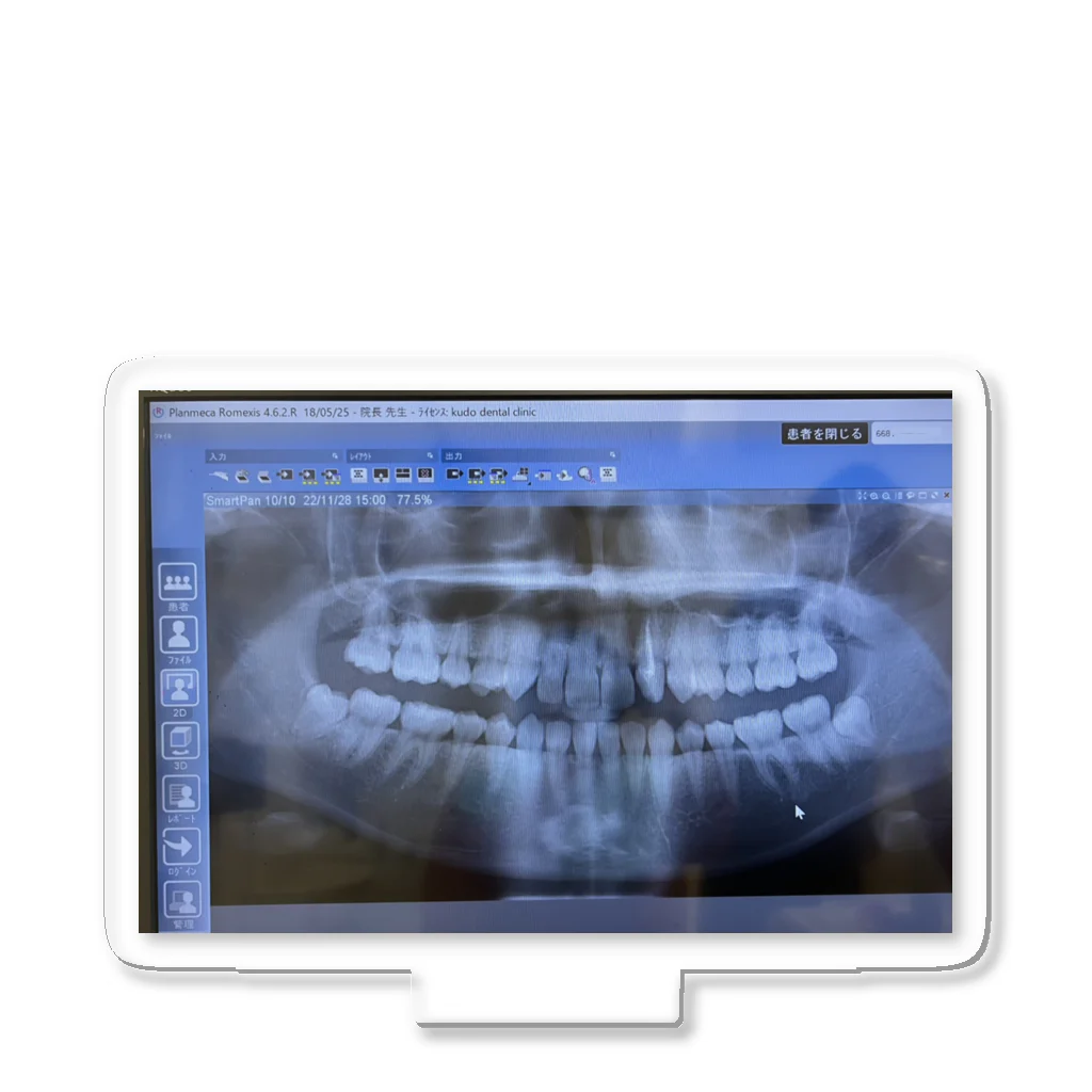 壊死の歯レントゲン2022年11月 Acrylic Stand