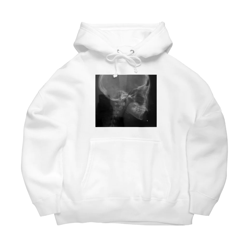 melty__oOの歯 Big Hoodie