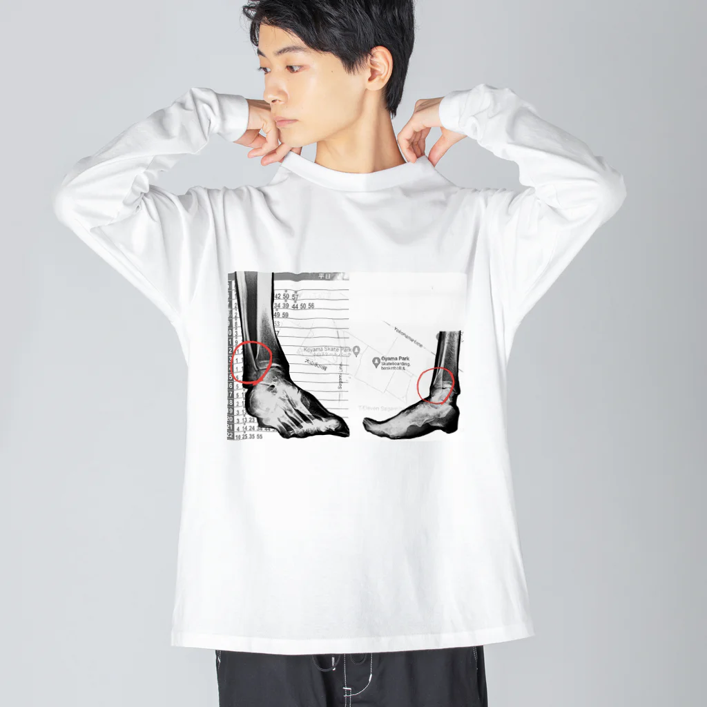 さとの骨折したワシのレントゲン ビッグシルエットロングスリーブTシャツ