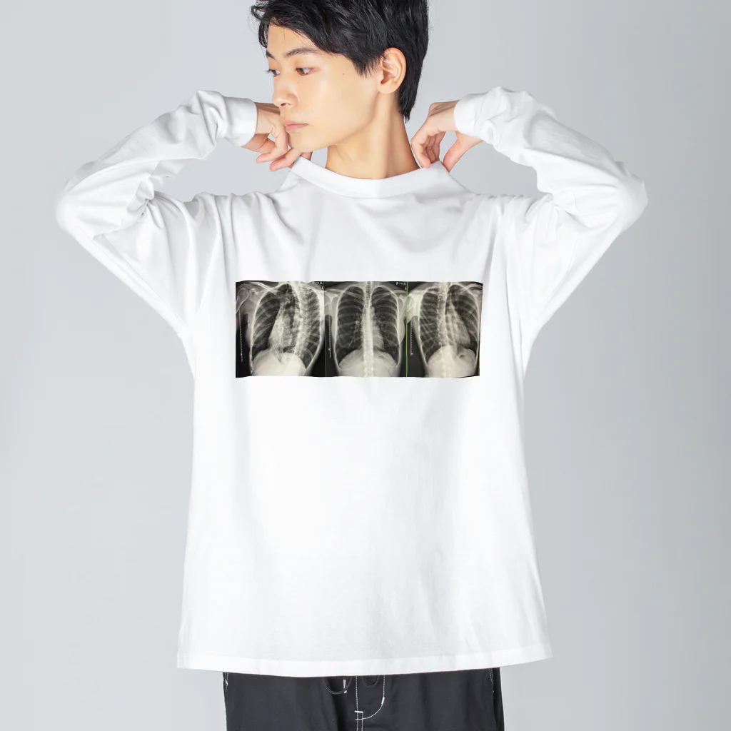 めだかのお店のわたしの肋骨レントゲン Big Long Sleeve T-Shirt