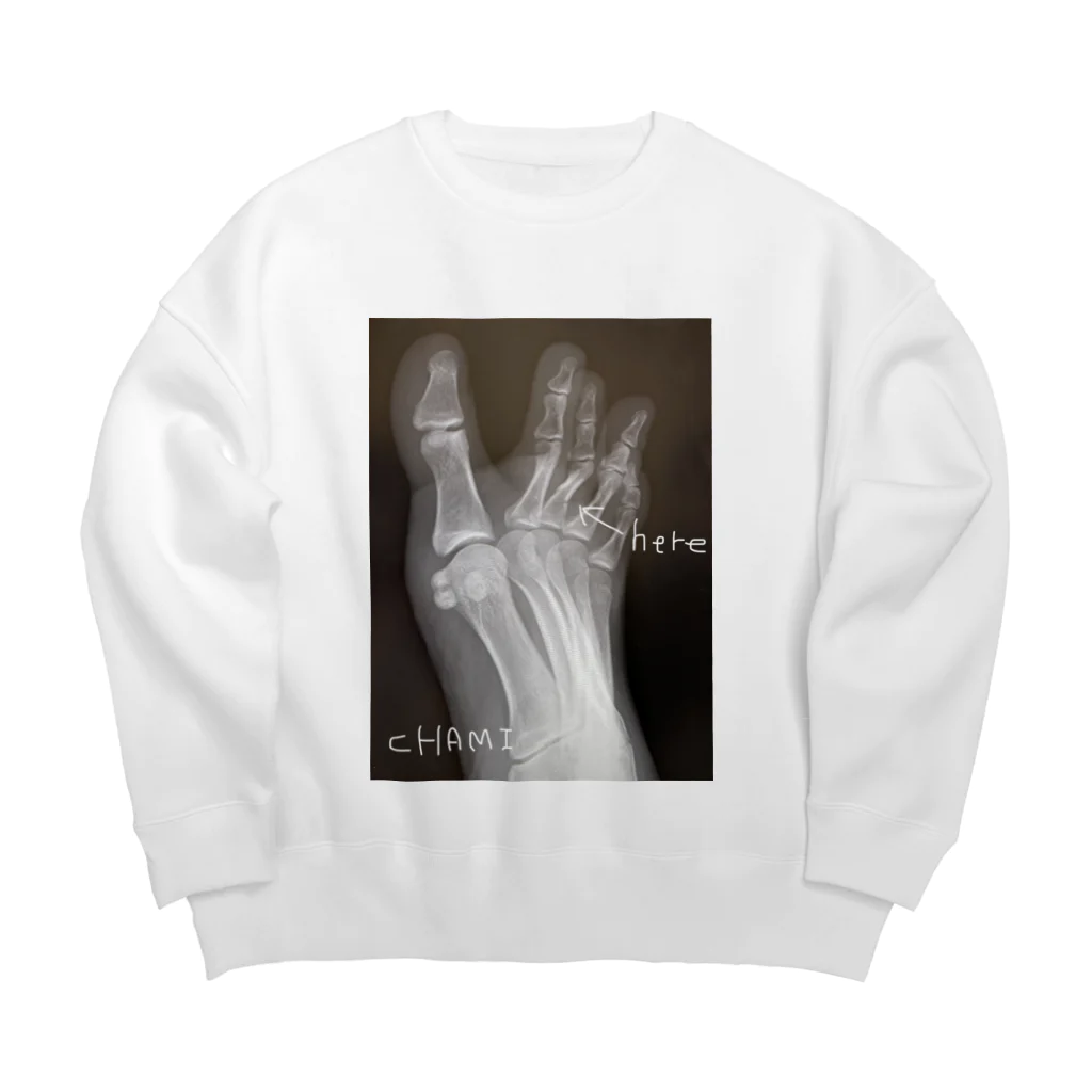 彩羽真矢のらくがきショップの【期間限定復活】骨折エンターテイメント2 Big Crew Neck Sweatshirt