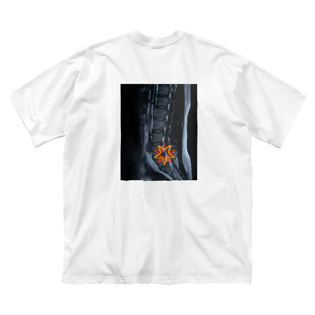 かりんこりんの椎間板ヘルニアに優しい世界 ビッグシルエットTシャツ
