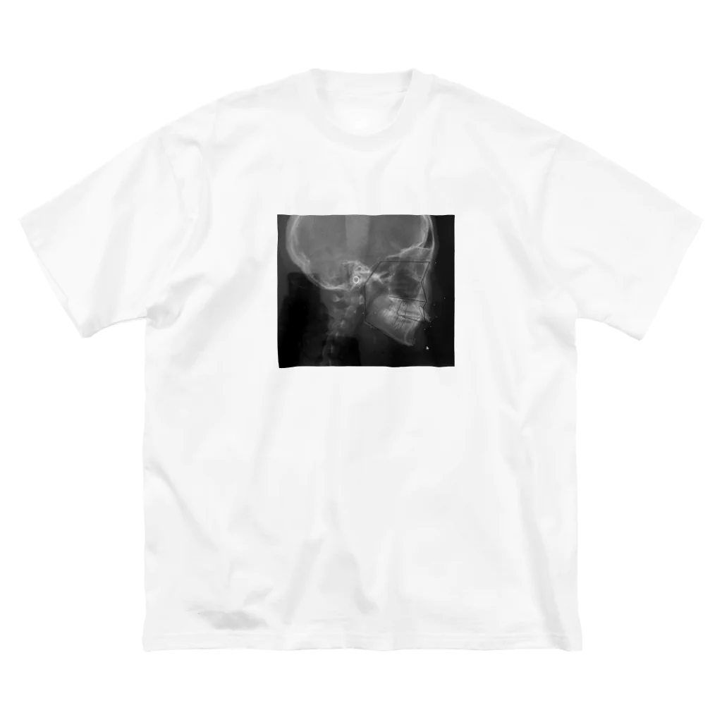 melty__oOの歯 Big T-Shirt