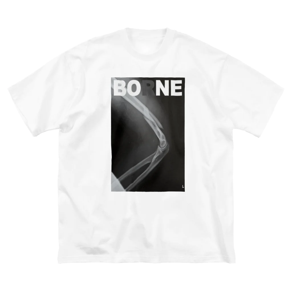 やまだのやまだの骨折グッズ Big T-Shirt