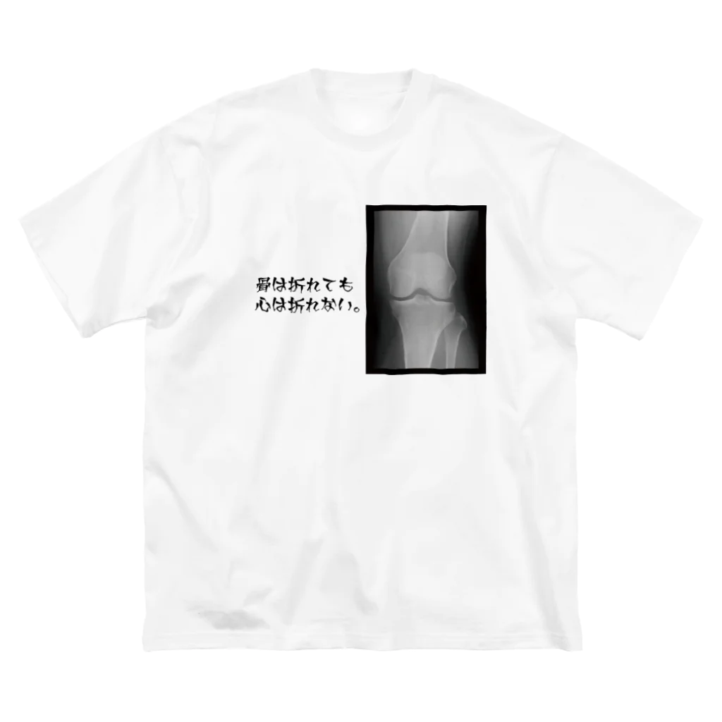 とりの とさかの骨は折れても心は折れない。 ビッグシルエットTシャツ