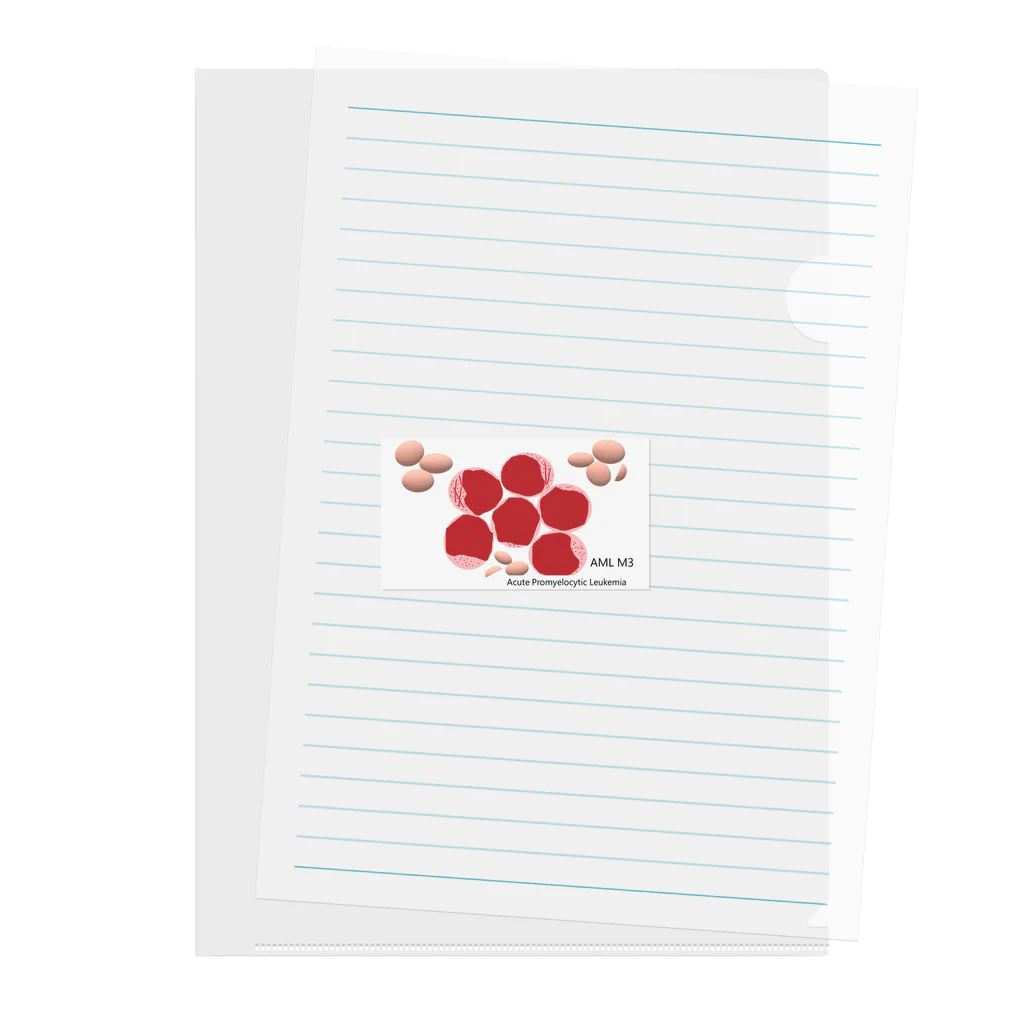 MedTechのAcute Promyelocytic Leukemia Clear File Folder