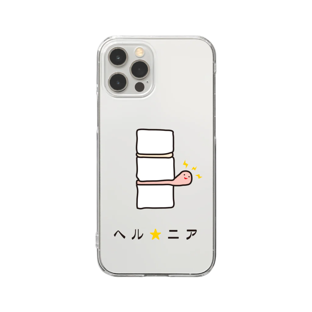 たちこーのヘルニアちゃん Clear Smartphone Case