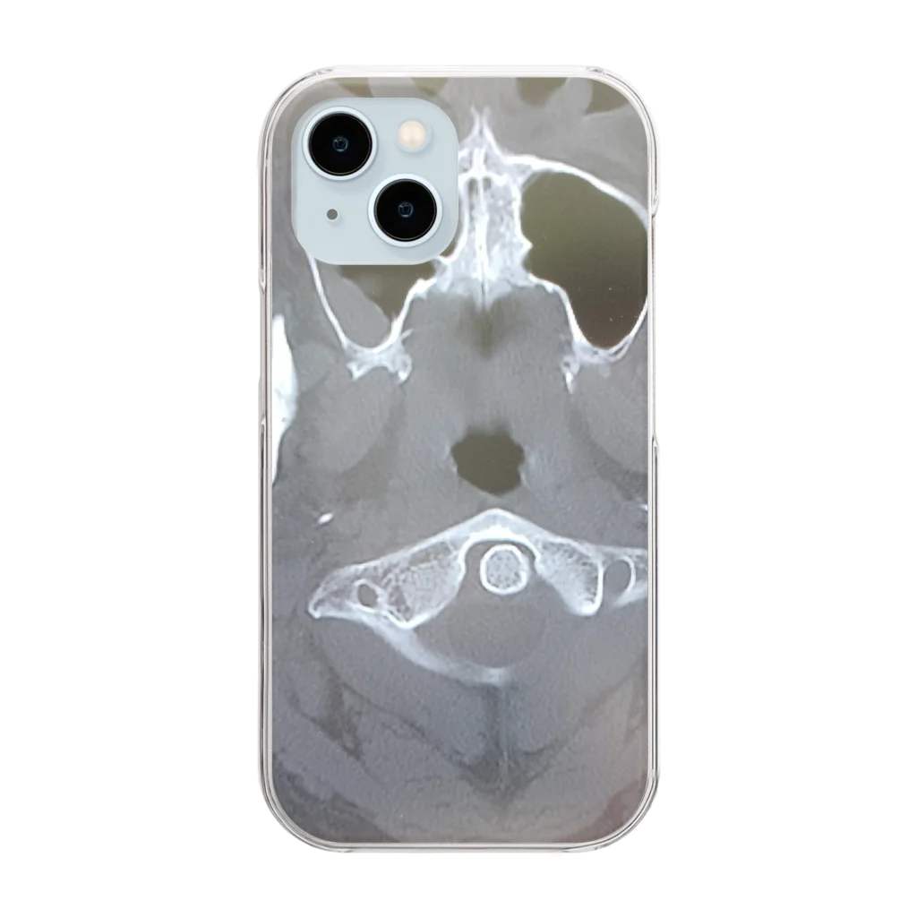 yryuuの脳のCTスキャン Clear Smartphone Case