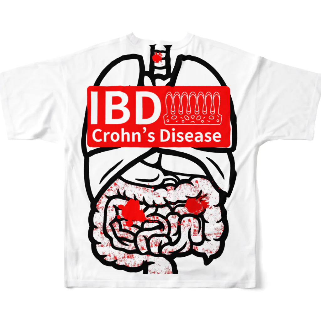 大逆天 Daigyakuten-onlineのクローン病患者が作るIBDシリーズ All-Over Print T-Shirt :back