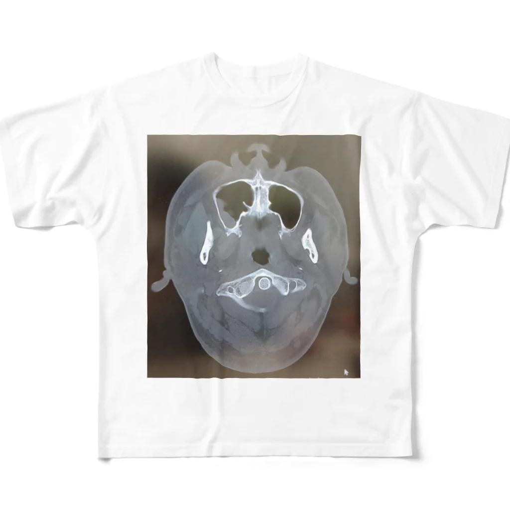 yryuuの脳のCTスキャン All-Over Print T-Shirt