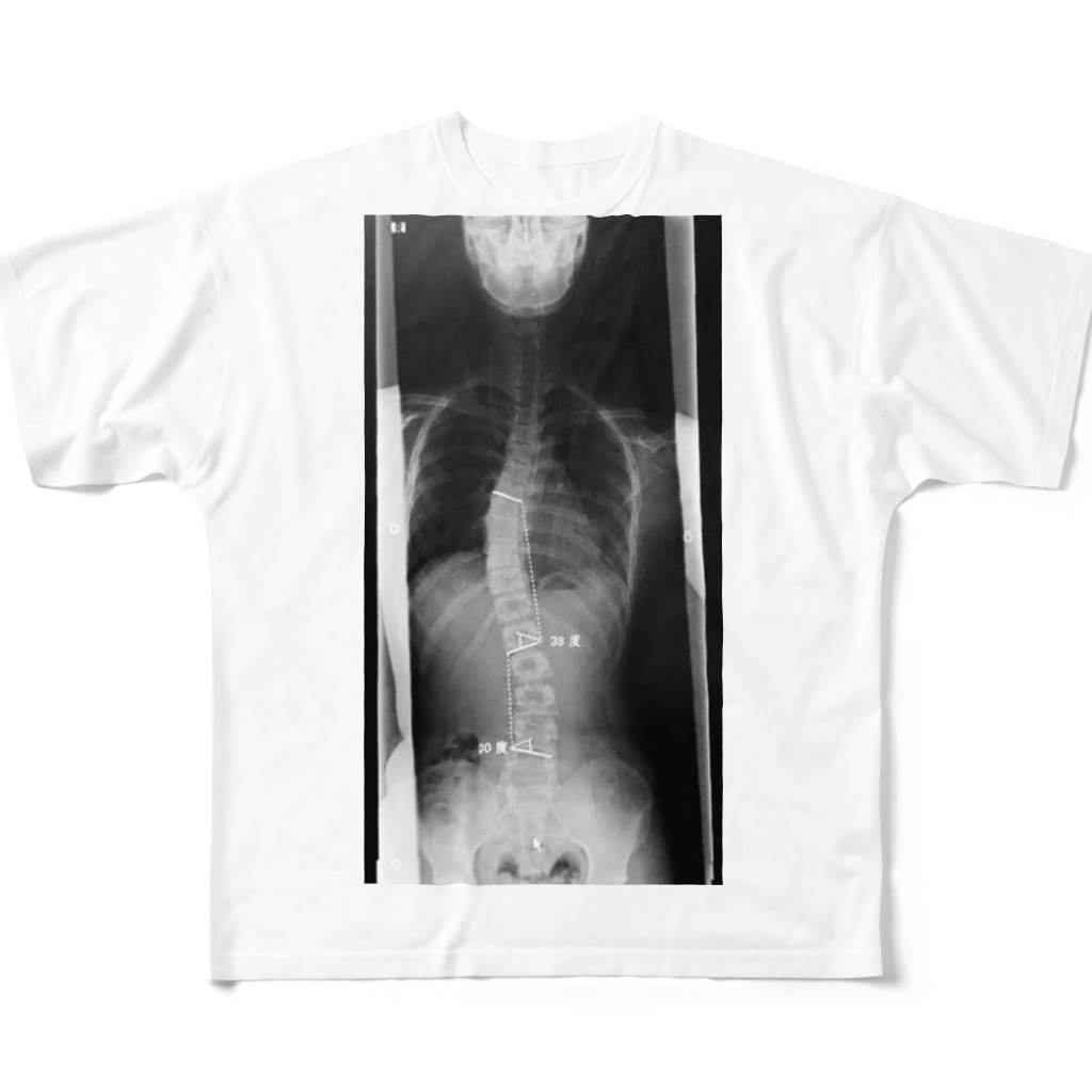 東京サイコパスのをに＠ぐんそーの背骨ヌード　無印 All-Over Print T-Shirt