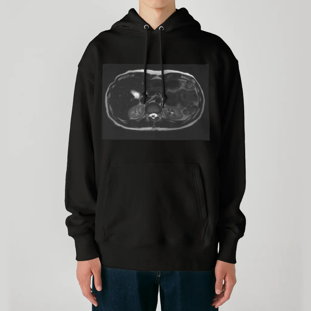 健康診断の俺の輪切りの俺（アップ） Heavyweight Hoodie