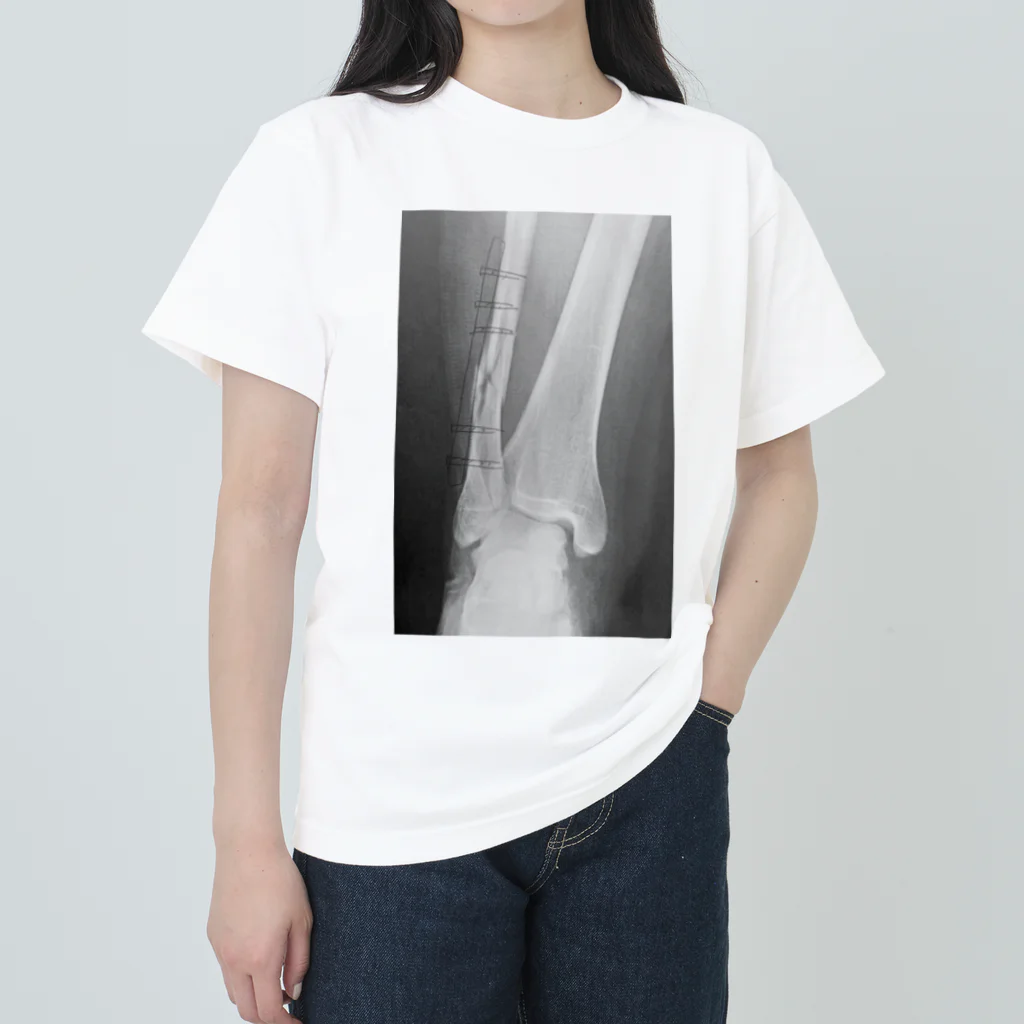 しゃったーみゅーじあむのBroken Leg ヘビーウェイトTシャツ