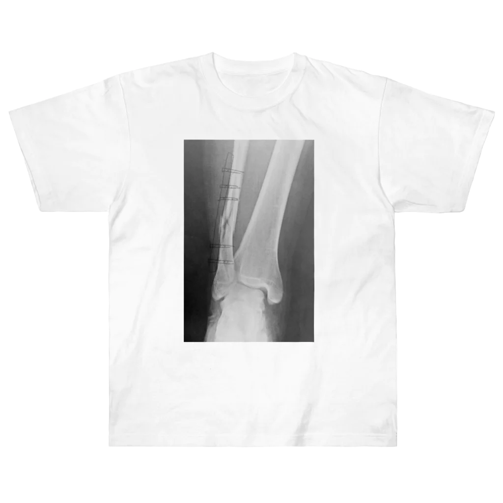 しゃったーみゅーじあむのBroken Leg ヘビーウェイトTシャツ