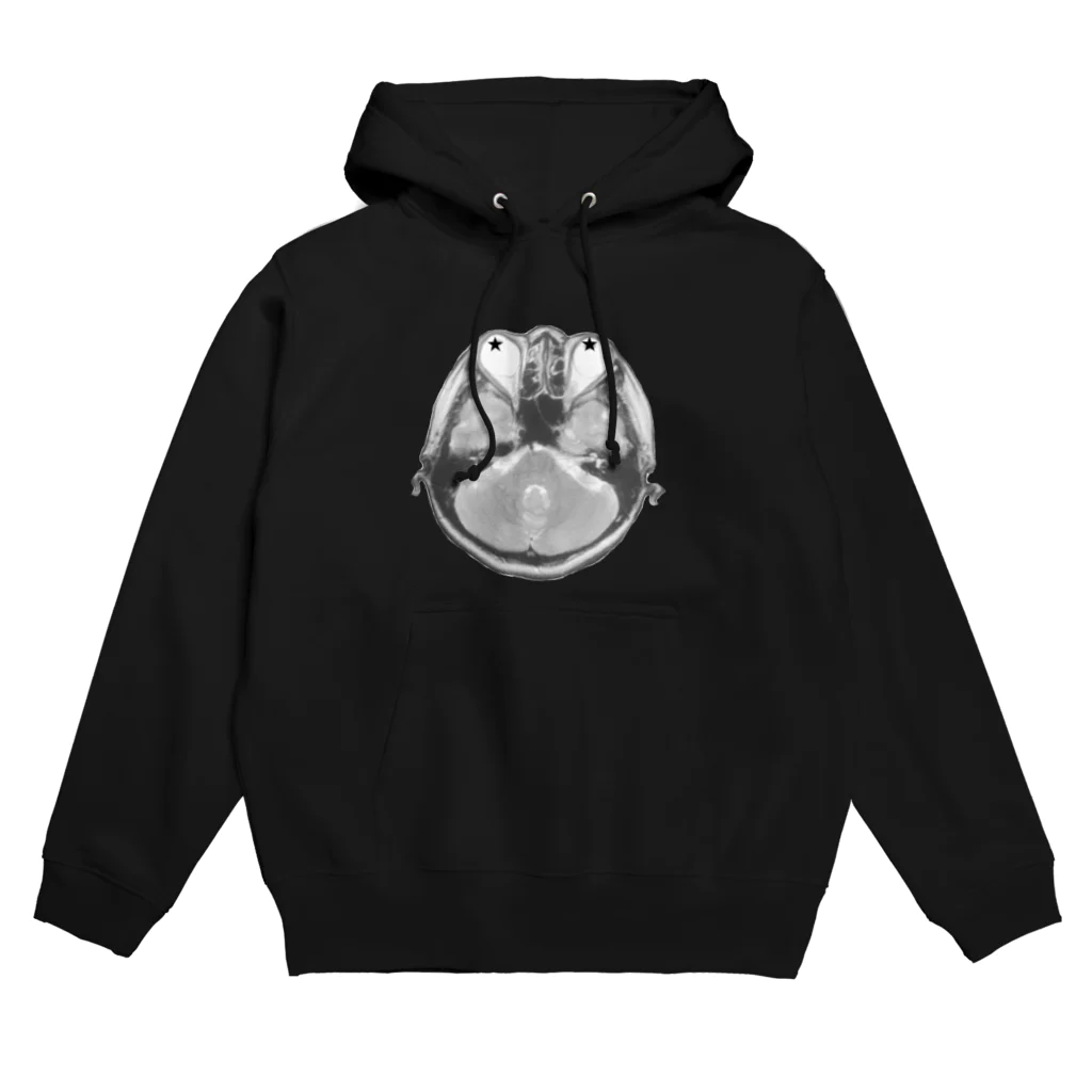 R15の偏頭痛パーカー Hoodie