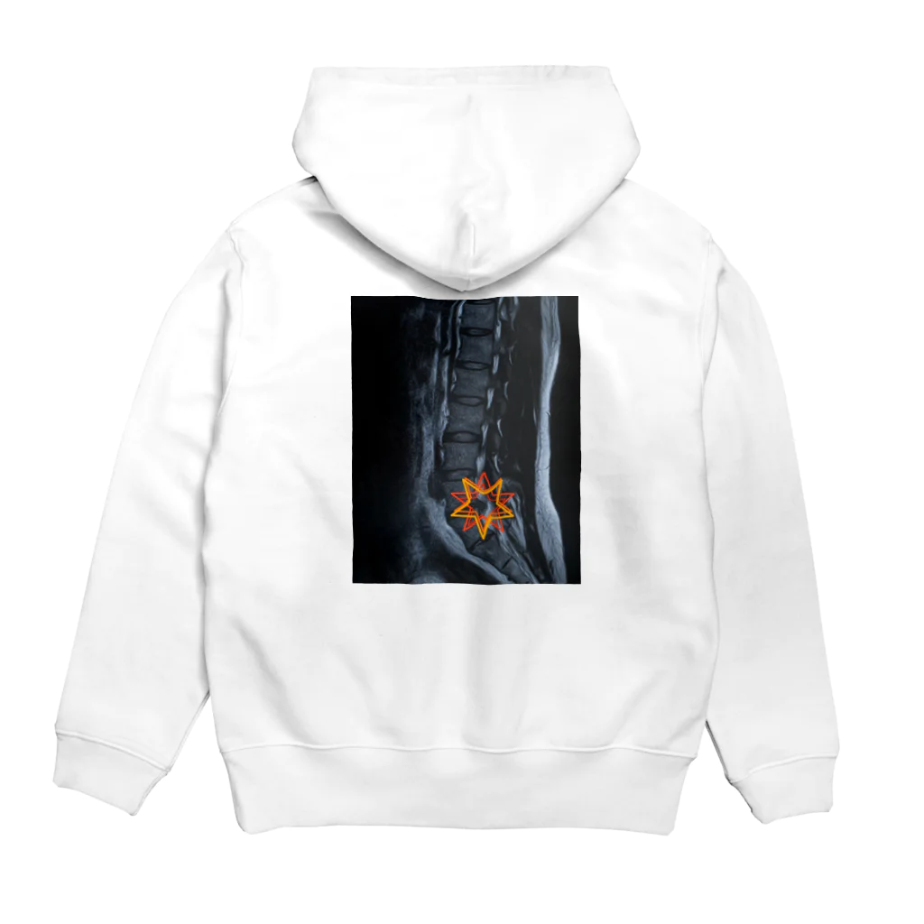 かりんこりんの椎間板ヘルニアに優しい世界 Hoodie:back