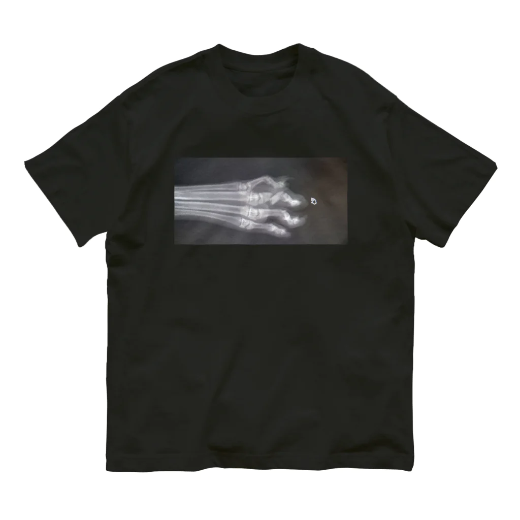 shopping_uniPonの骨折レントゲン写真 Organic Cotton T-Shirt