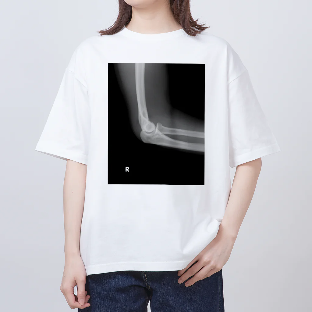 Deadfoolの骨折T Oversized T-Shirt