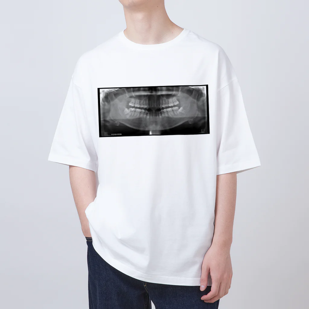 little MAKES.のX-ray of teeth(歯のレントゲン) オーバーサイズTシャツ