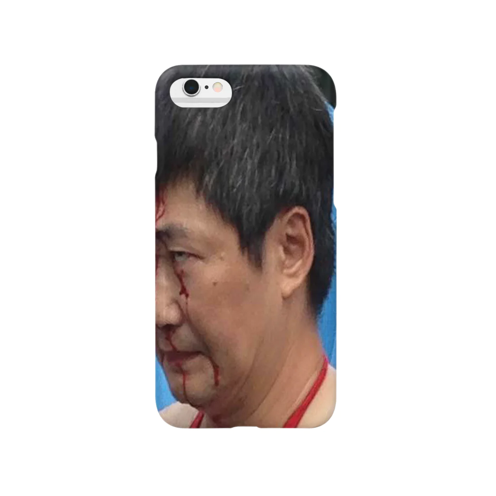 顔面goldの流血おじさん Smartphone Case