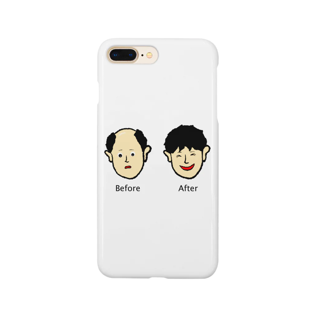 ツンデレボーイズの増毛 Smartphone Case