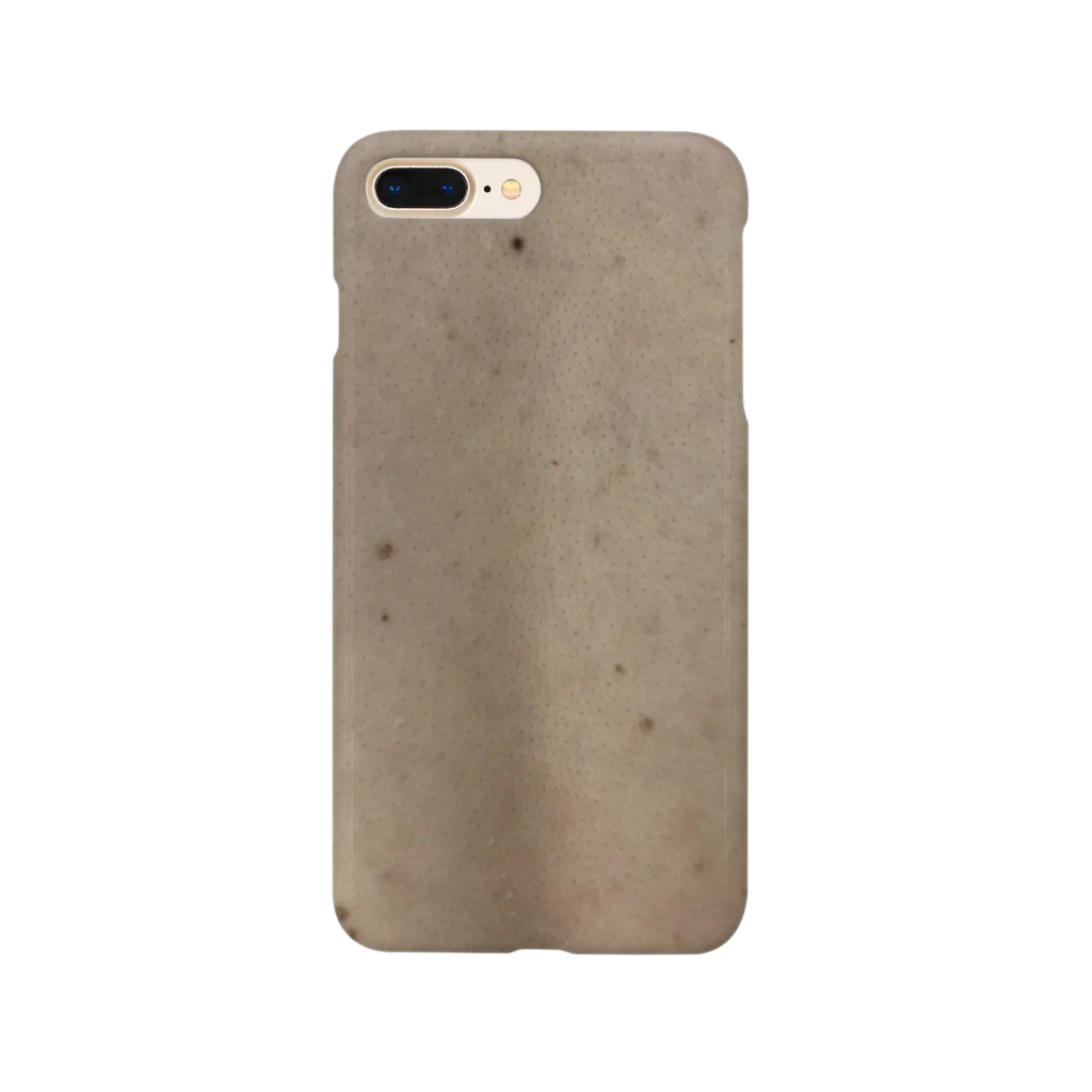 anemiaの姉の皮膚 Smartphone Case