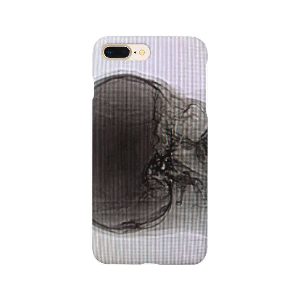 S@の超個人情報 Smartphone Case