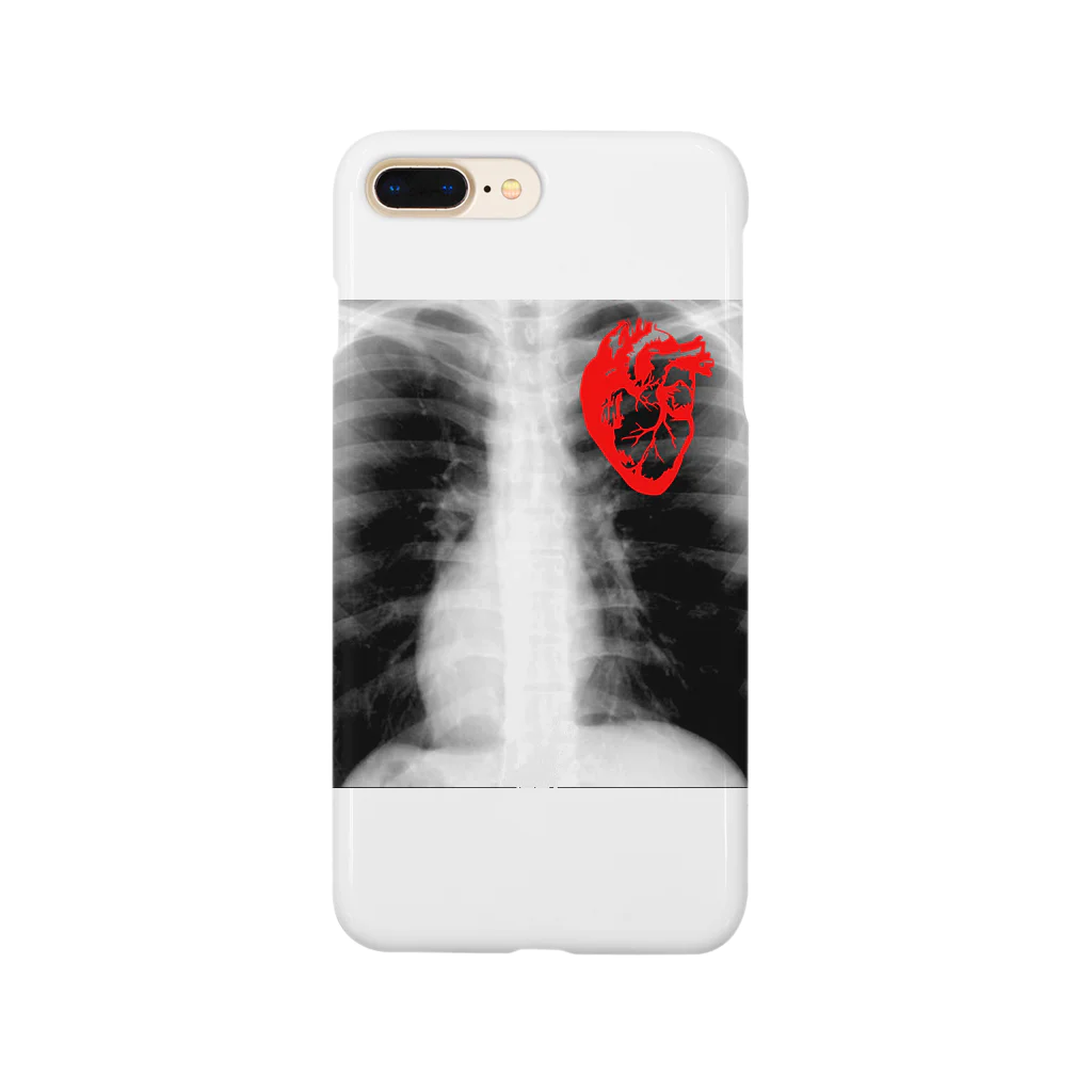 FabergeのX-ray Smartphone Case