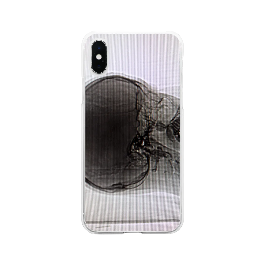 S@の超個人情報 Soft Clear Smartphone Case