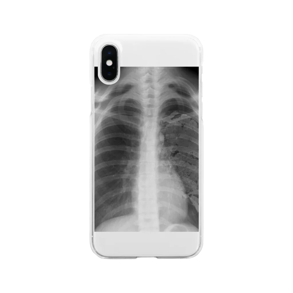 HIRAのあの子の肺 Soft Clear Smartphone Case