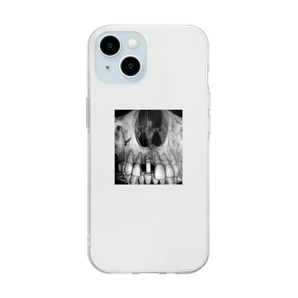 Atelier501のTHE implant Soft Clear Smartphone Case