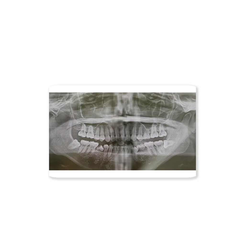 Official LunaLollyのLunaLolly's sukesuke dental x-ray ステッカー