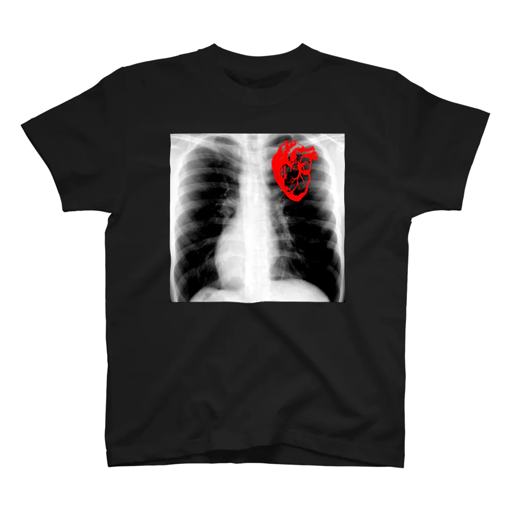 FabergeのX-ray スタンダードTシャツ