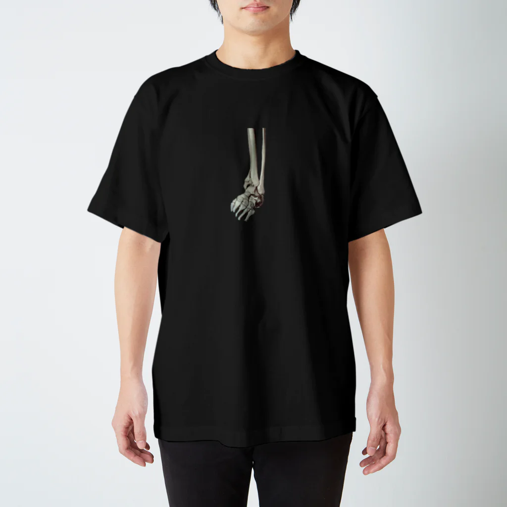 KOBUSHIの左脛骨遠位端骨折CT画像（くり抜き） Regular Fit T-Shirt