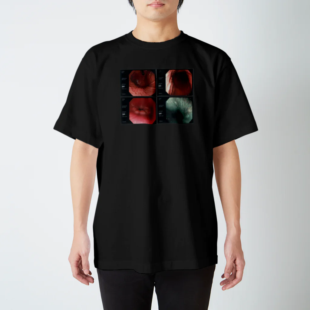 鈴木お肉マートの【グロ注意】　胃カメラ　記念品 Regular Fit T-Shirt