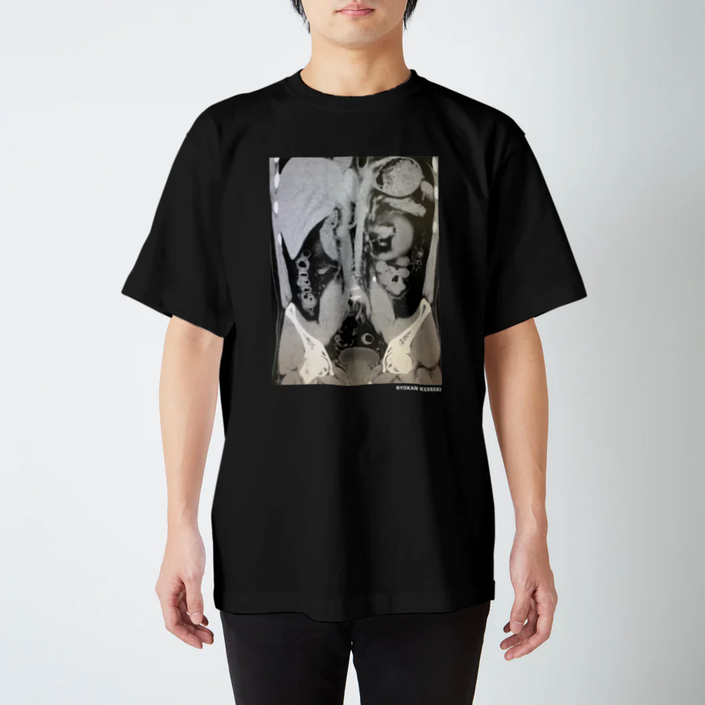 km2の尿管結石 Regular Fit T-Shirt