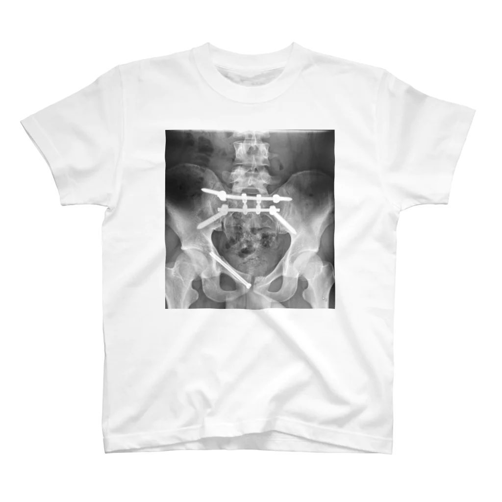 カロネの長男の骨盤 Regular Fit T-Shirt