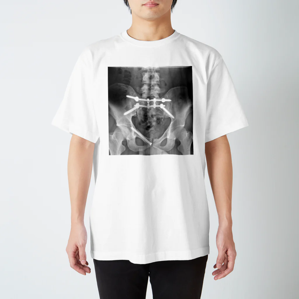 カロネの長男の骨盤 Regular Fit T-Shirt