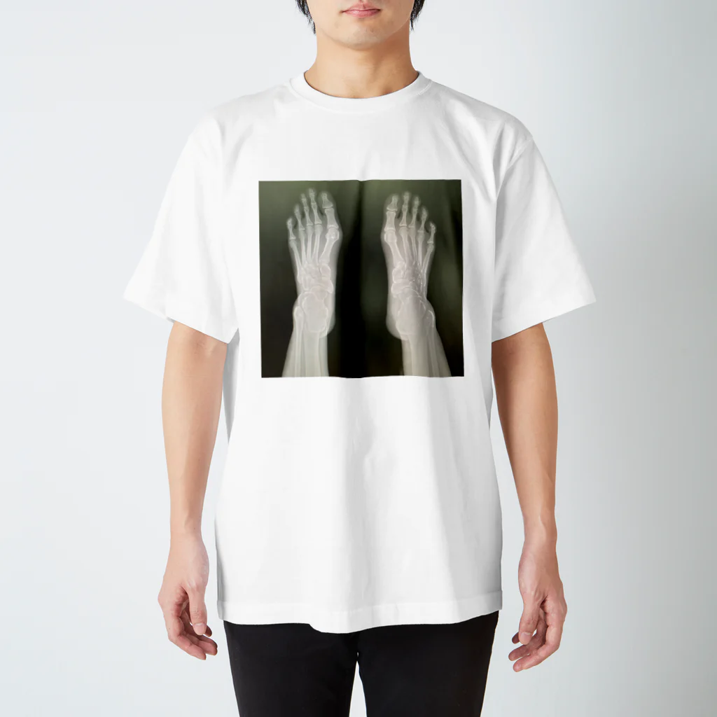 mijinko_jinkoのbreak a leg  Regular Fit T-Shirt
