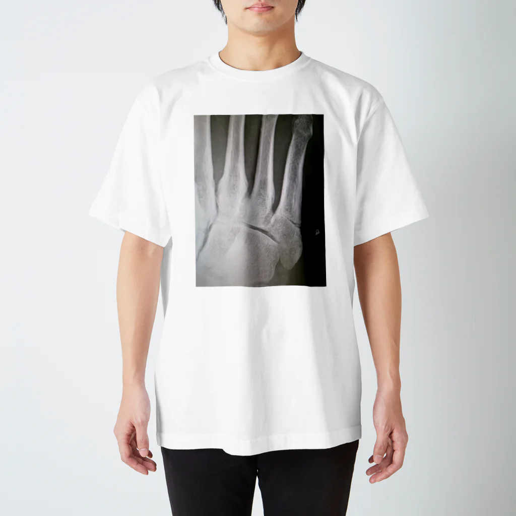 武工房の骨折レントゲンTシャツ Regular Fit T-Shirt
