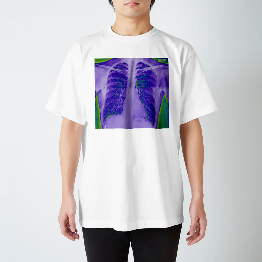 肺気胸男のサイケデリック肺気胸 Regular Fit T-Shirt