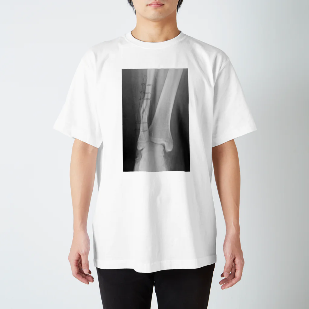 しゃったーみゅーじあむのBroken Leg スタンダードTシャツ