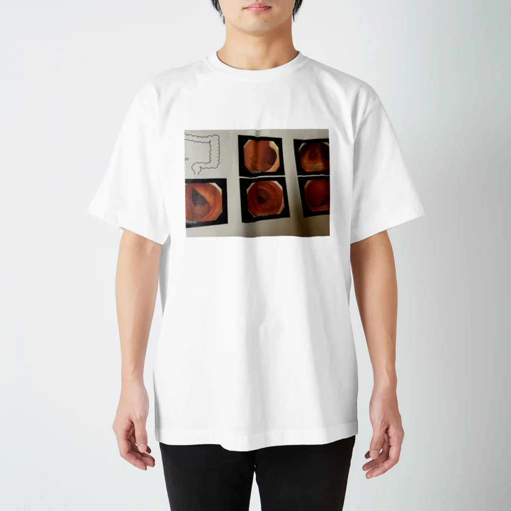 oculophiliaahの私の綺麗な大腸 Regular Fit T-Shirt