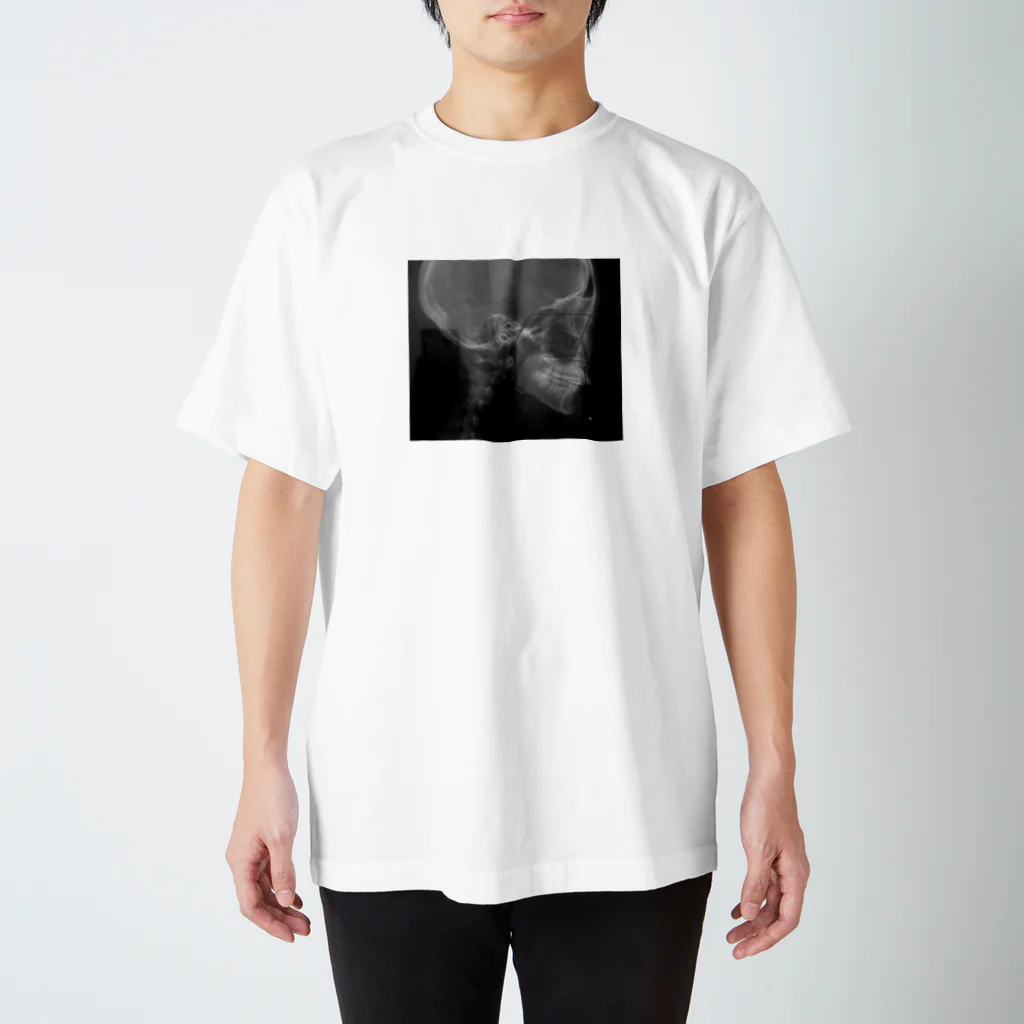 melty__oOの歯 Regular Fit T-Shirt