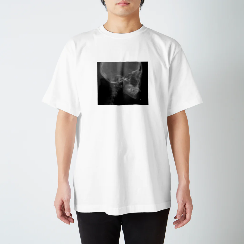 melty__oOの歯 スタンダードTシャツ