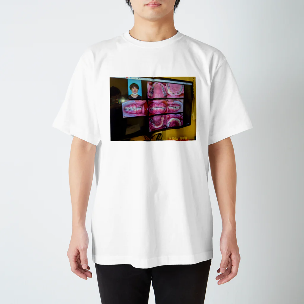 琵琶 光太郎の個人情報 スタンダードTシャツ