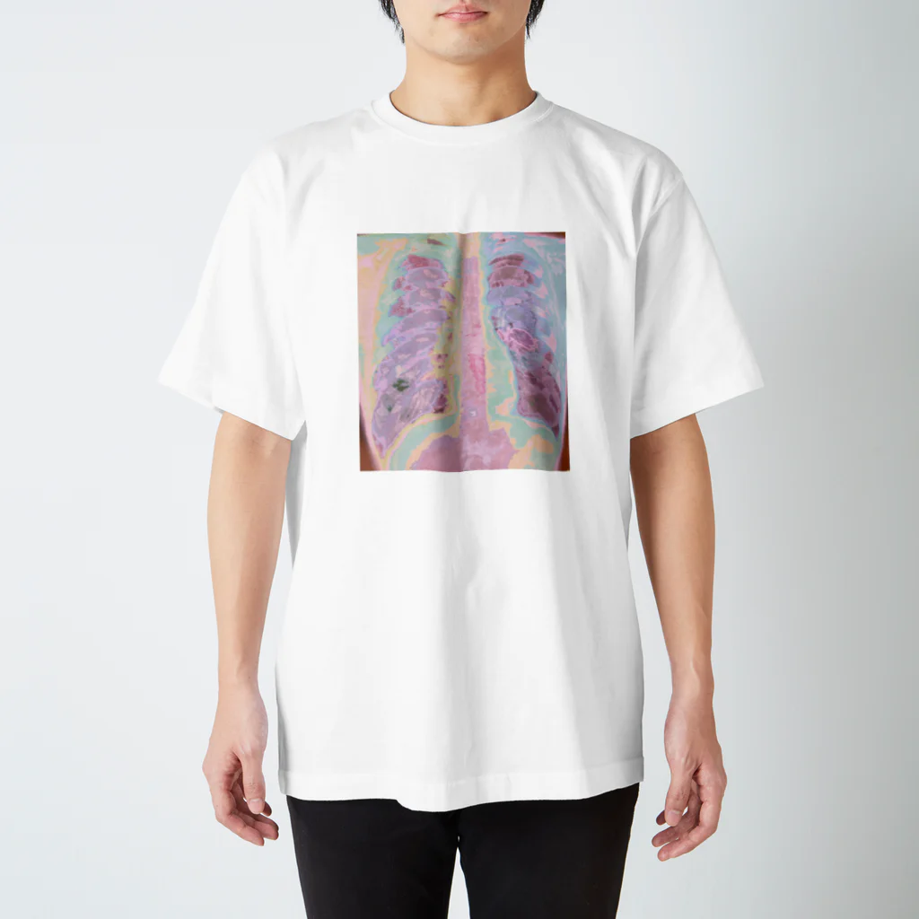 zarazarazara35のエキゾチック肺 スタンダードTシャツ