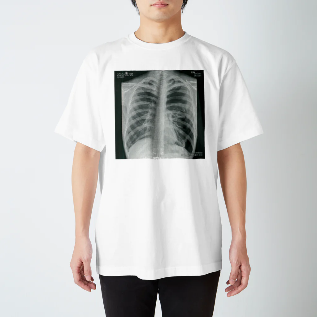 mztnの肺気胸のレントゲン写真 Regular Fit T-Shirt