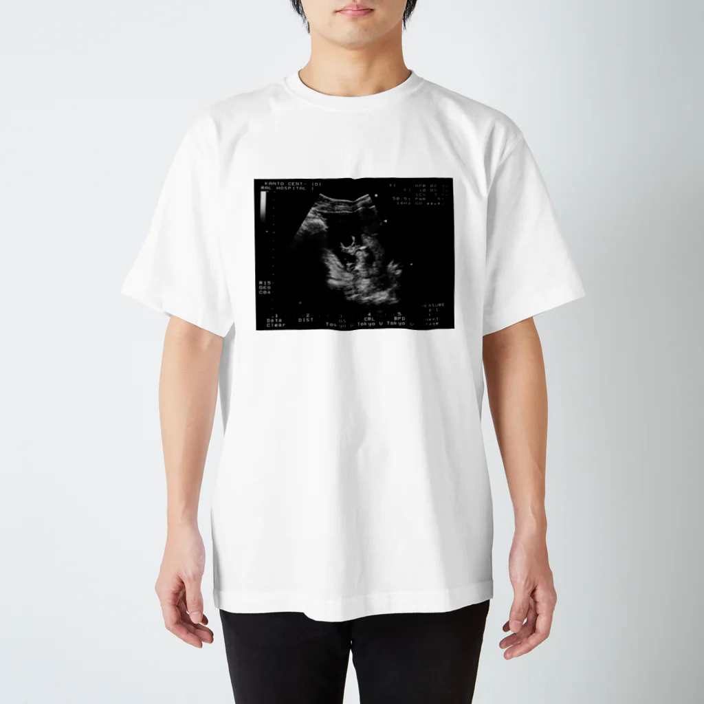 フザリウムの-6ヶ月のえださこ Regular Fit T-Shirt